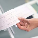 elettrocardiogramma a riposo